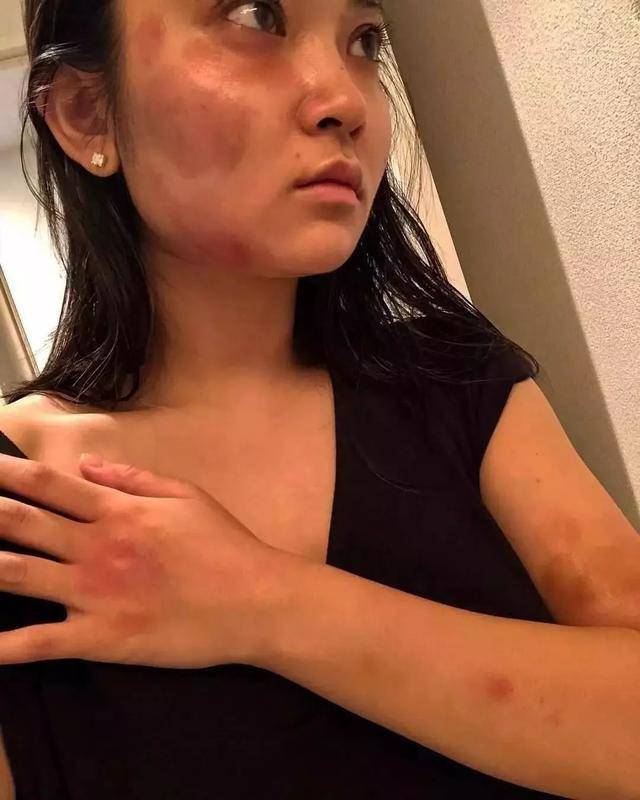 最新家暴女朋友，社会警钟长鸣，呼吁共同关注与制止